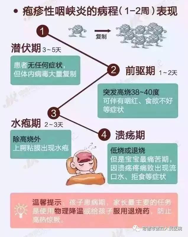 疱疹性咽炎高发,你的宝宝中招了吗?