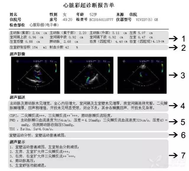 心超报告结构和各指标正常值 目前我国超声心动图报告格式尚未完全