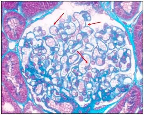 图 1 绿色:肾小球脏层上皮细胞(足细胞)或壁层上皮细胞;深灰色:肾小球