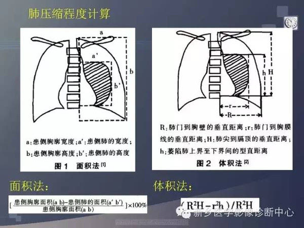 实用!几张小图轻松教您气胸测量方法