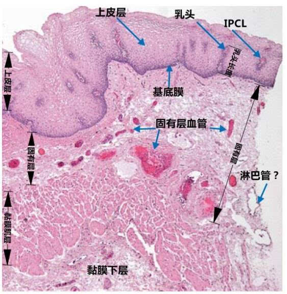 颜色区域是上皮层,由多层的鳞状上皮细胞组成,上皮层的最下方为基底膜