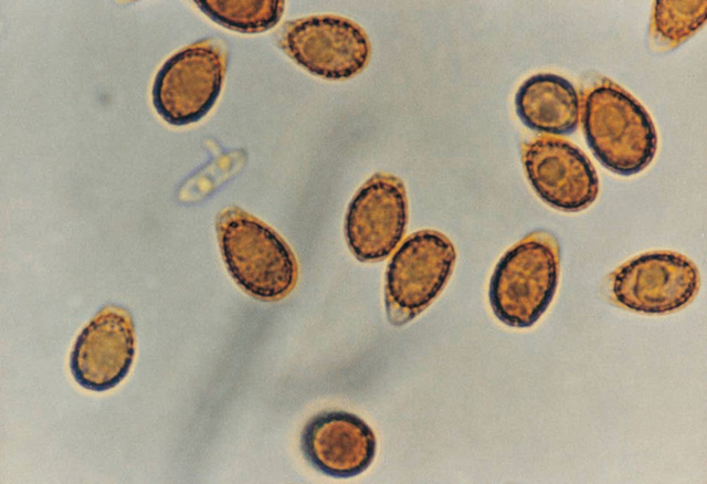 光学显微镜下的灵芝孢子形态.