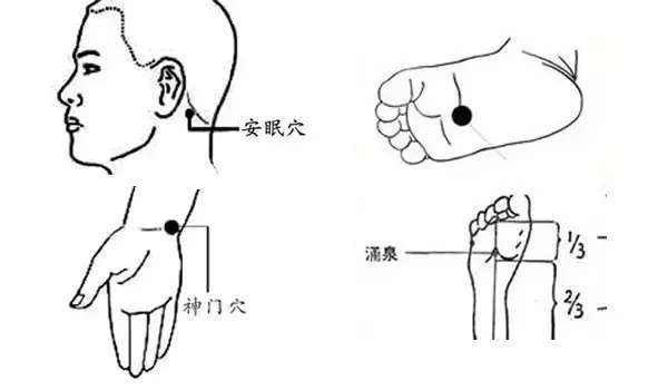 艾灸治疗失眠效果好