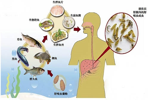淡水鱼虾中可能有什么寄生导致人患肝吸虫病_肝片形吸虫_吃生鱼片患肝吸虫病