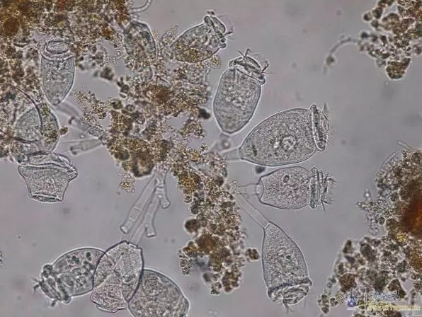 【图谱·下】说说活性污泥微生物镜检(下)之运行