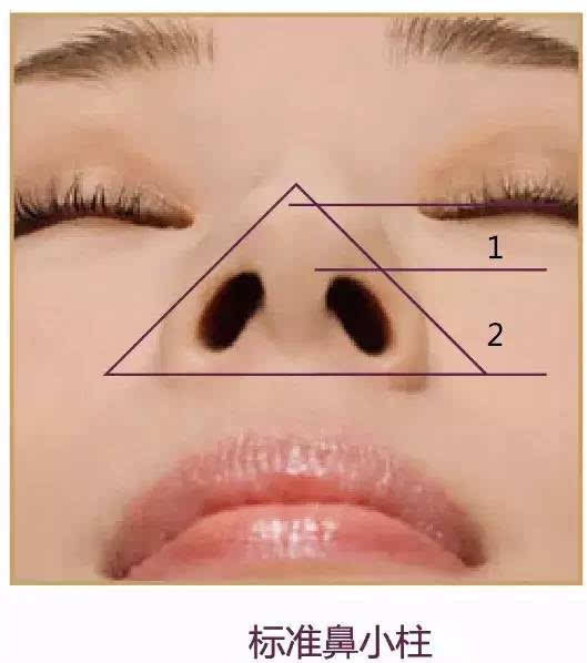 标准鼻小柱 鼻小柱与上唇人中呈90度.