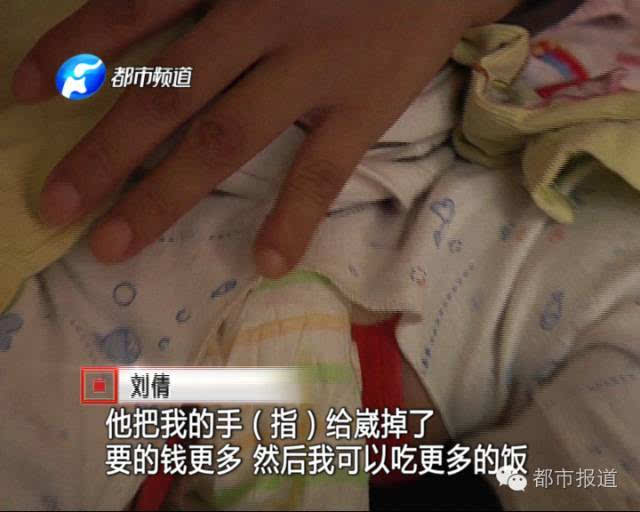 【揪心】幼时被拐,手指被砍掉,天桥上乞讨….如今她