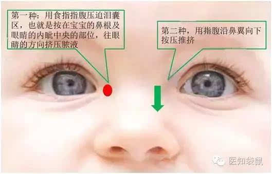 宝宝流眼泪,长眼屎背后的疾病,让眼科专家告诉你