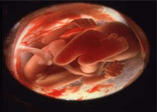 怀孕|发现胎儿无胎心怎么办?