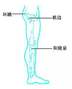 艾灸这样治坐骨神经痛,附穴位图!