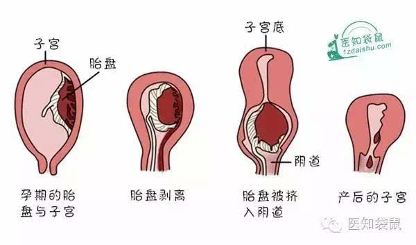 产后恶露是怎么回事?谁说它是脏东西?