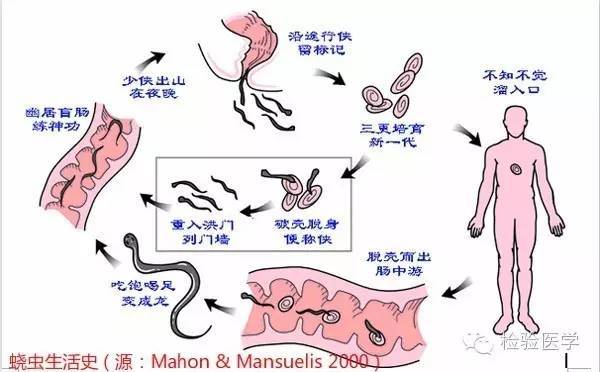 蛲虫妈妈产卵记(附视频)