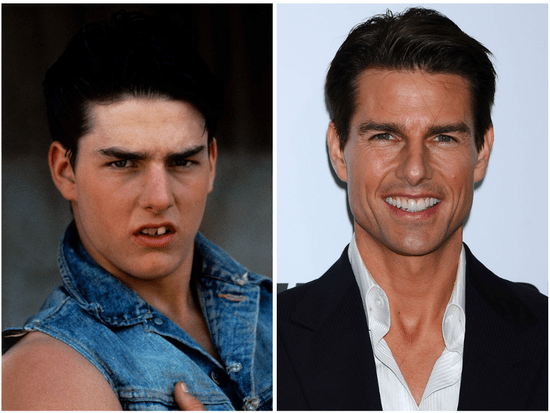 汤姆·克鲁斯(tom cruise)即使对于颜值高的人来说牙齿好不好也非常的