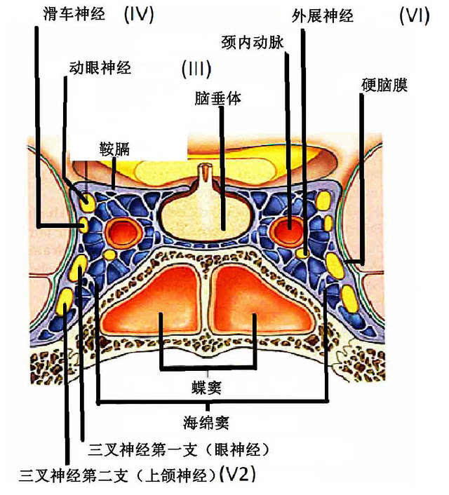 外侧壁自上而下依次为动眼神经,滑车神经,眼神经和上颌神经