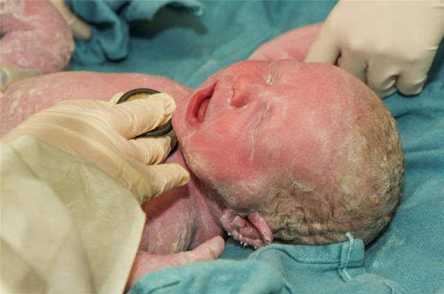 在孩子出生时,胎脂是外面那层白白的东西.
