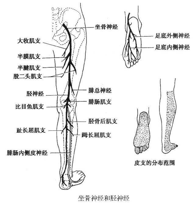 坐骨神经痛的诊断