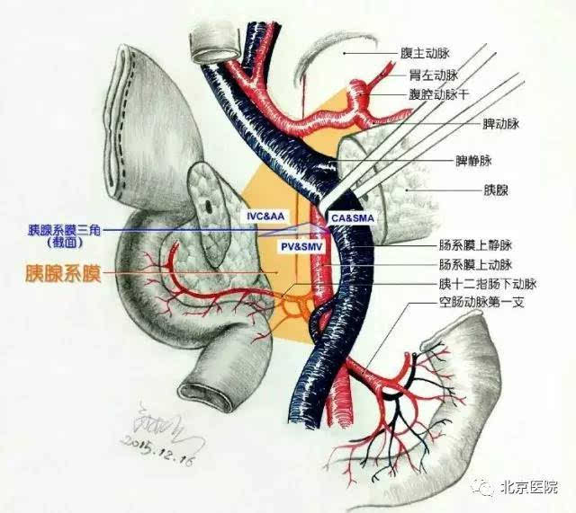 京医求精 | 北京医院肝胆胰外科团队克服胰十二指肠切除术消化道重建