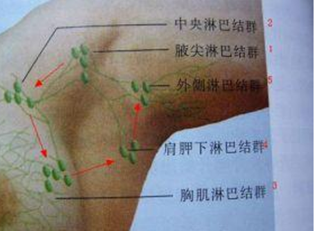 腋窝淋巴结是乳腺淋巴回流的主要站 乳腺和腋窝的联系其实是靠两处的