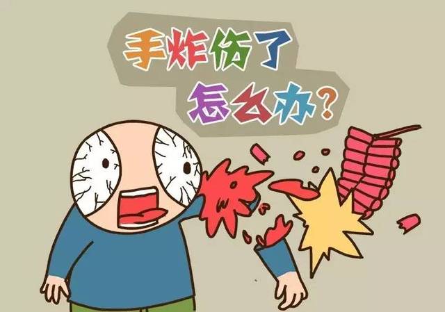 【健康】手部炸伤怎么办?