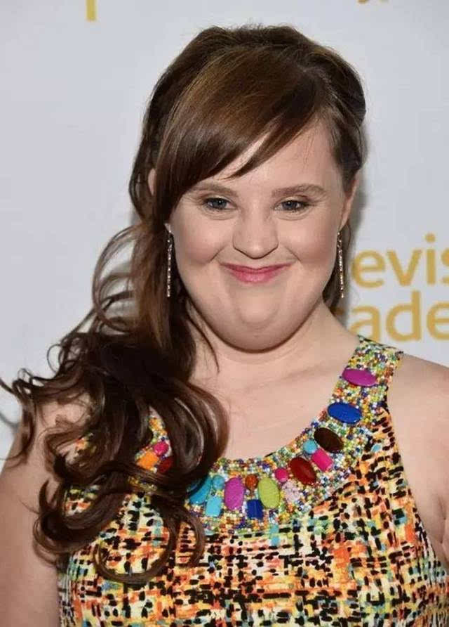 jamie brewer 世界首位唐氏综合征模特,她还在电视剧《美国恐怖故事》