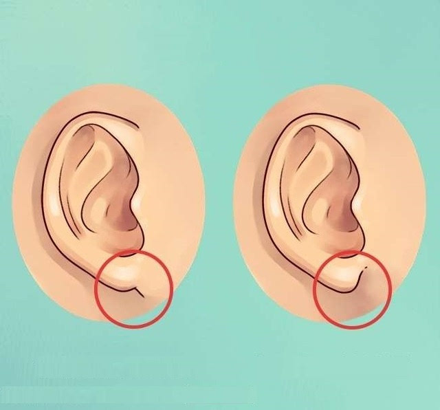 耳朵除了用来听东西,还可以看出你的健康状况!
