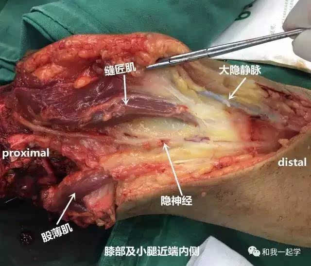 骨哥阅片课堂:膝关节鹅足的实战解剖