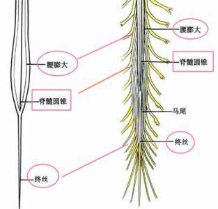 脊髓拴系综合征