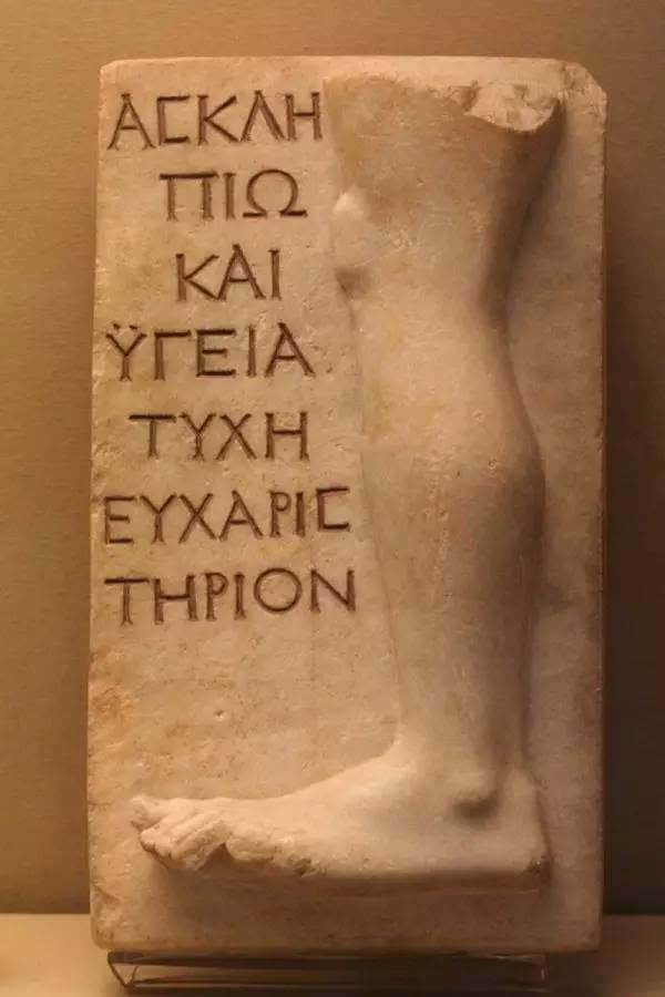 古希腊神庙里为何那么多残肢断臂的雕塑?