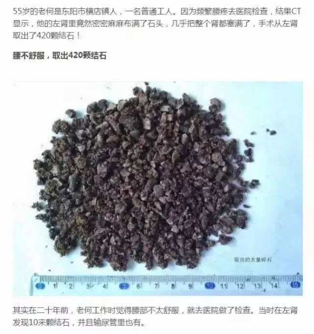 豆姓人口_小锦时间 吃错了樱桃 可能会要命(2)