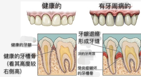 c454d10155844e8bb19d5ab382600741_th.jpg