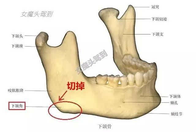 (敲黑板)下颌角就是你耳朵下方,脸上那块凸出来的骨头.