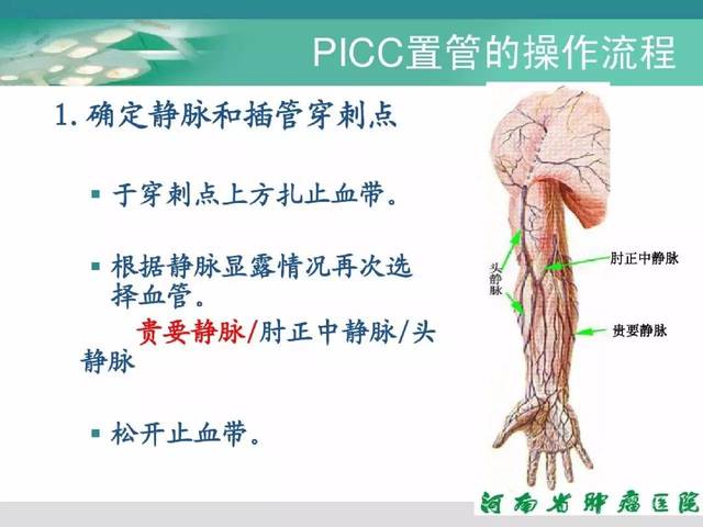 经外周置入中心静脉导管