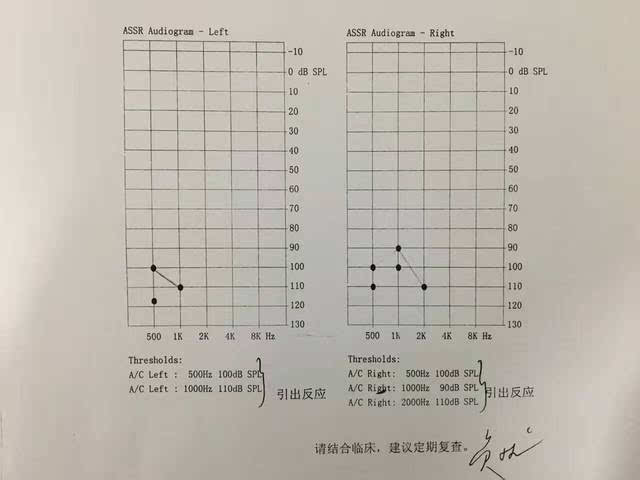 听力检查精准的重要:中耳炎引起的"重度听损?