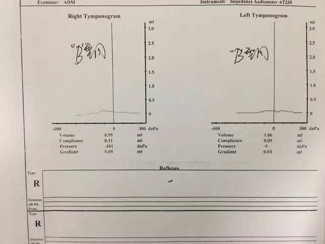 图一声导抗检查结果