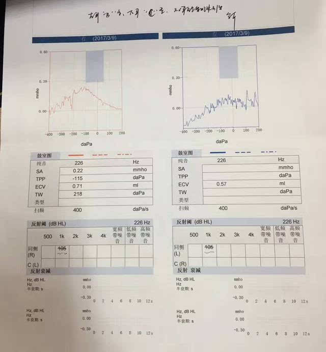 图八声导抗结果