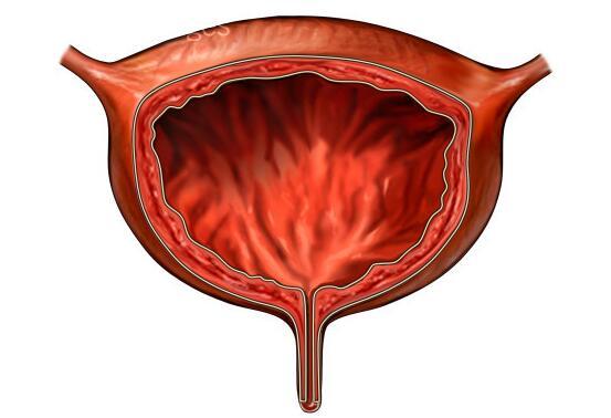 一发现尿尿是红色的,就很可能是膀胱癌,需警惕!