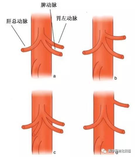 腹腔干及其分支正常解剖示意图