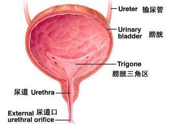 患膀胱肿瘤反复血尿怎么办?