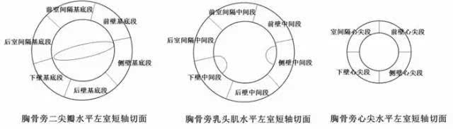 3 左心室收缩功能异常①视觉评估:胸骨旁左室短轴切面下,左室应呈