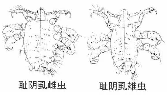 聊点儿你们都想知道的,私处的毛该不该脱?