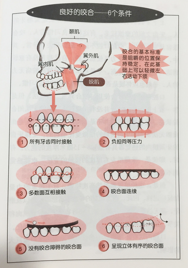 正确的咬合是什么?