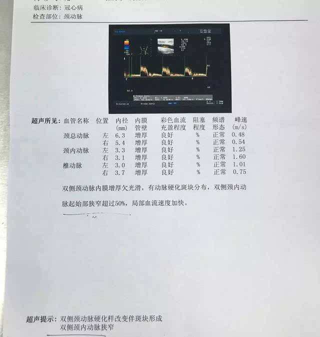 2mg/kg,枸橼酸舒芬太尼注射液0.6ug/kg,2%利多卡因0.