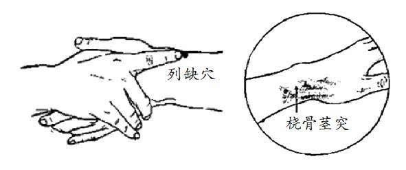 列缺穴:专治头颈疾病奇穴