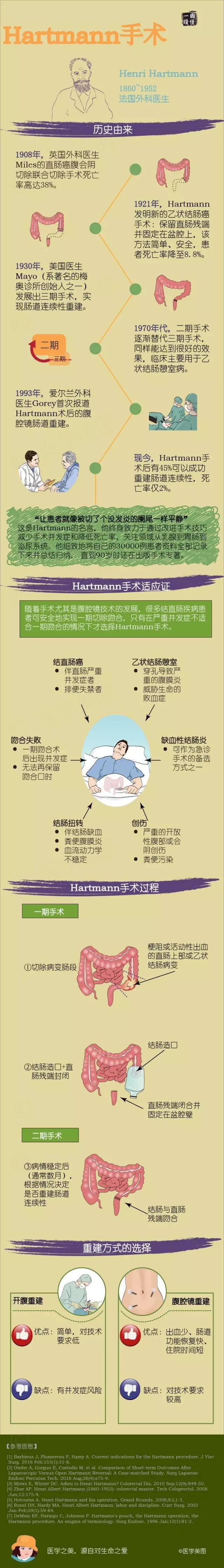 图说| hartmann手术