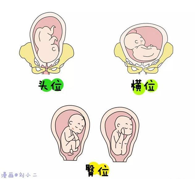 她的二宝因为胎位不正最后选择了剖腹产,宝宝倒是顺顺利利的生了下来