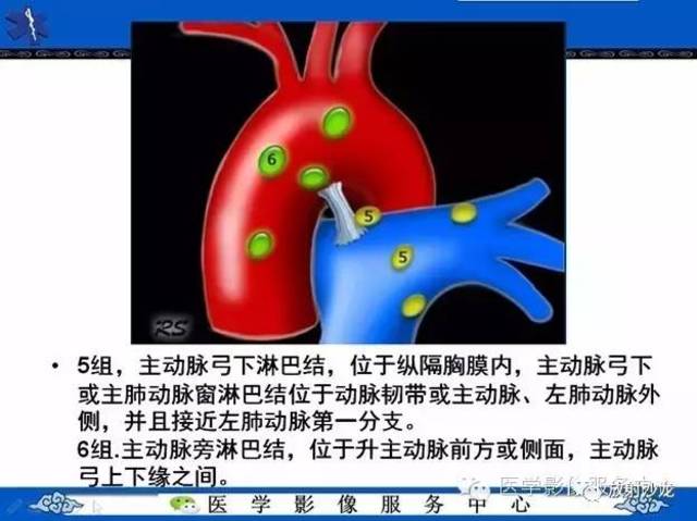 从常见部位看:在ct诊断中如何发现纵隔淋巴结增大