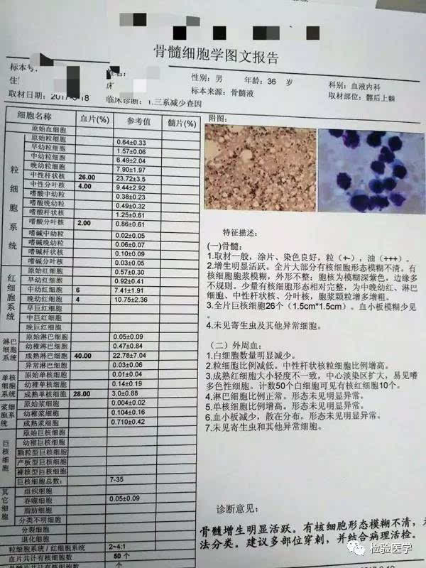 一例由嗜血细胞综合征引起的骨髓坏死