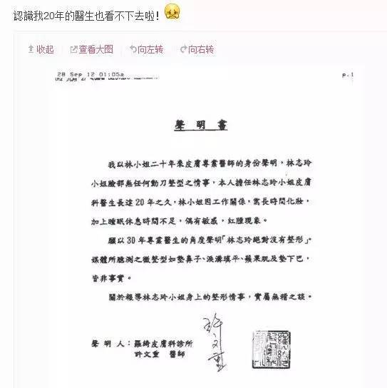 bye2变脸大s肿了还坚持自己天生丽质,明星为了证明没整容也是够拼的