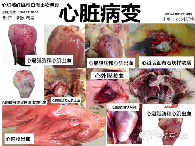 心脏被纤维蛋白渗出物包裹 大肠杆菌病:心脏被纤维蛋白渗出物包裹 鸭