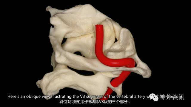 椎动脉解剖